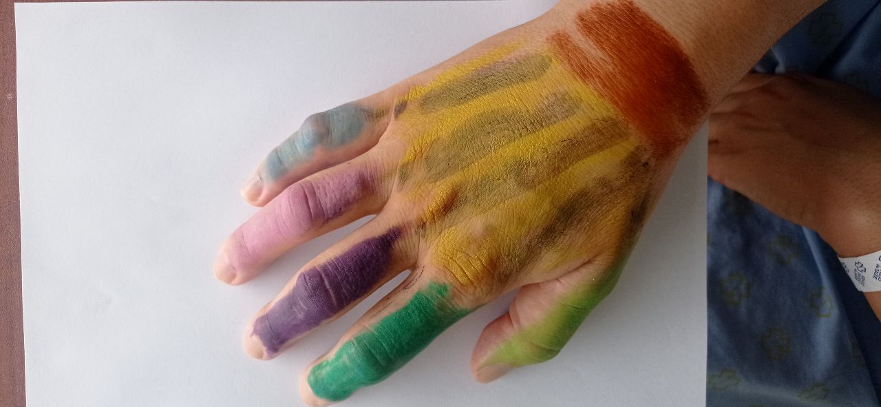 Arteterapia autointervención artística mano hemiplejia